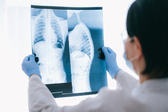 Pulmonologist compares smoker's lungs vs. healthy lungs after quitting - scientific evidence Doctor examining a smoker's lung X-ray, demonstrating why it's important to know how to quit smoking successfully.