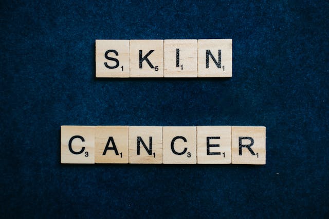 Skin cancer awareness: wooden block letters on blue background Skin cancer" spelled out with wooden blocks on a blue background, a reminder of the health risks associated with smoking and the importance of learning how to quit smoking successfully